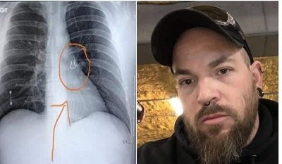 He has kept the E-ray as proof