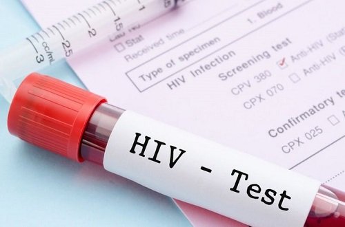 More people are testing positive for HIV
