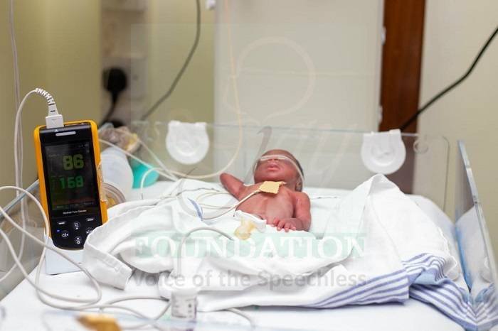 A preterm baby
