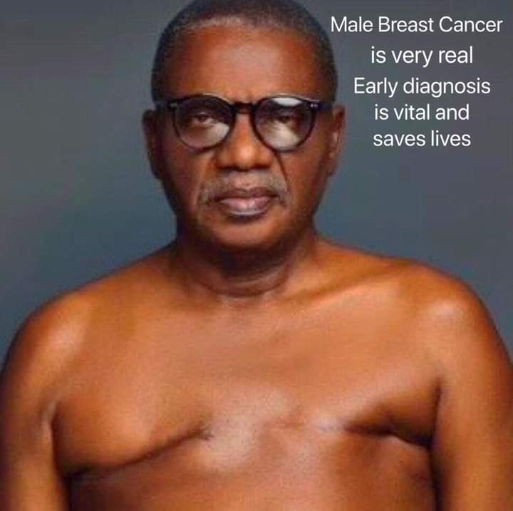 Mr  Arthur  showing  his breast  cancer  scars