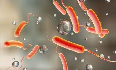 • Cholera virus