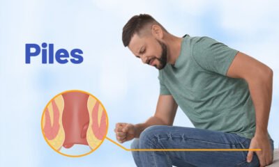 • Piles is now a national disease in Sikaman