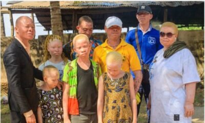 Some members of the albino community in Ghana