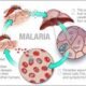 Malaria on the rise in Amansie West District