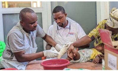 Health professionals attending to a child with clubfoot