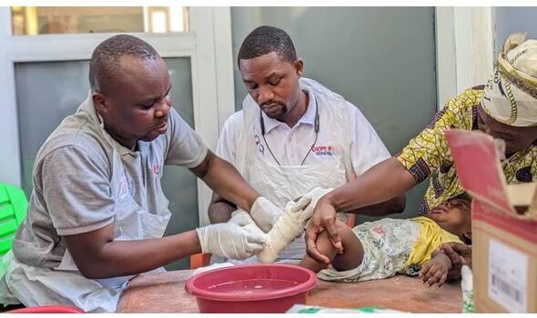 Health professionals attending to a child with clubfoot